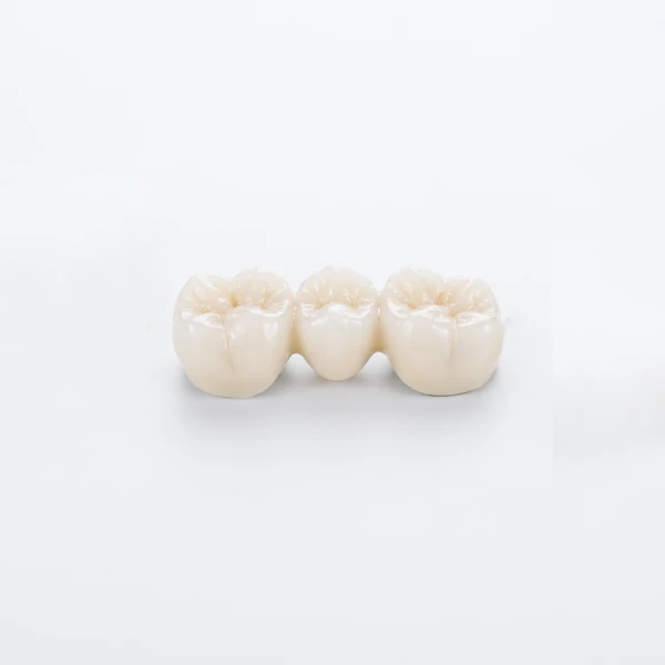 Dental_crowns