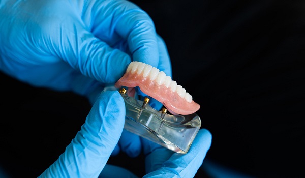 Kivehető fogpótlás - dentier