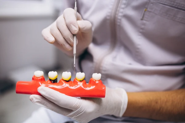 Esztétikai fogpótlások és implantátumok